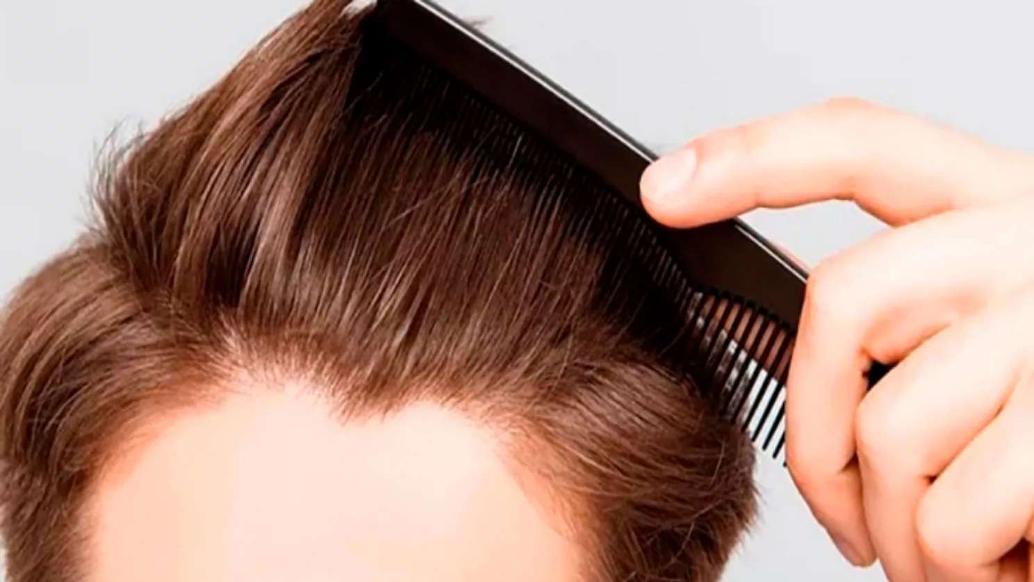 Specialized hair transplant clinic