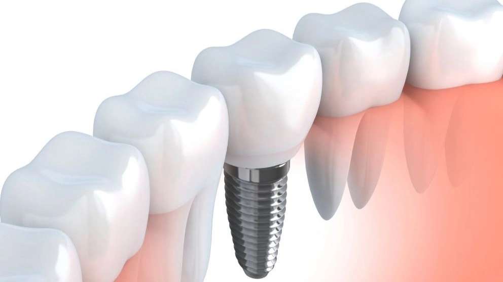 Biston Manbari Dentistry