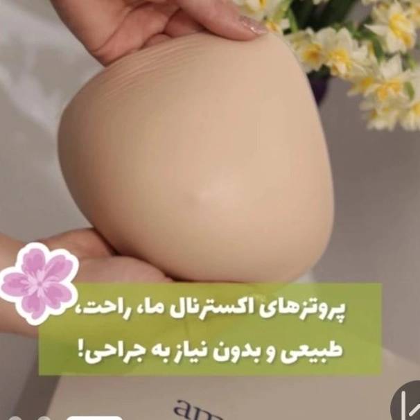 1777653335742.webp