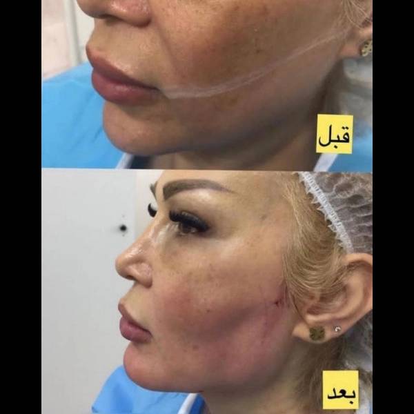 1710577502852.webp