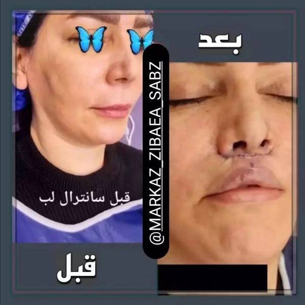 1710577552207.webp