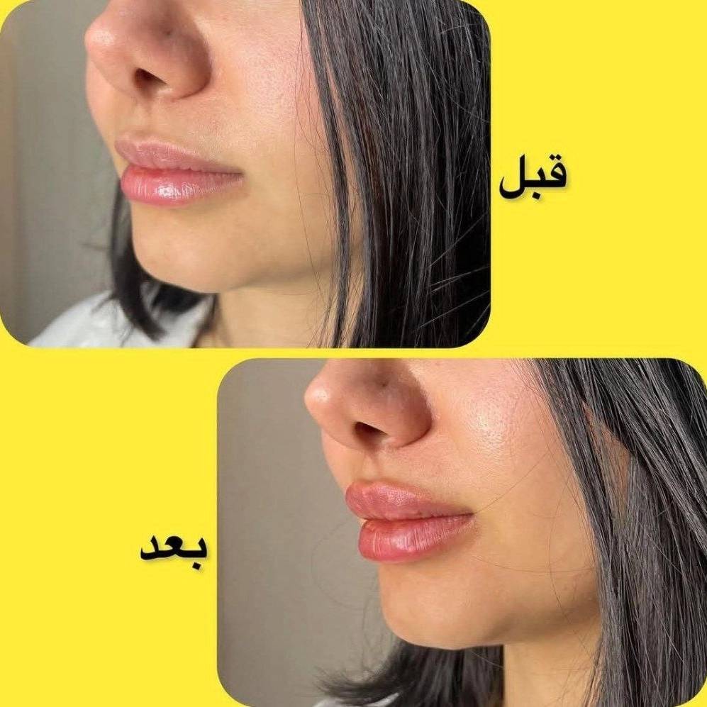 1740637385681.webp