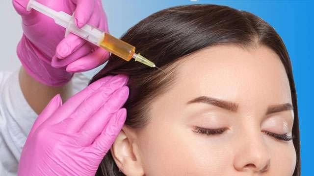 حقن البلازما الغنية بالصفائح الدموية (PRP).