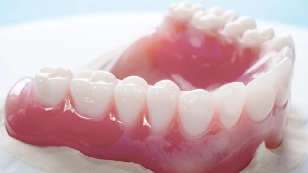 What is the color of dental laminate?
