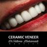Dr. Fatemeh Mohammadi Dental Clinic, Laminate Implant in Isfahan