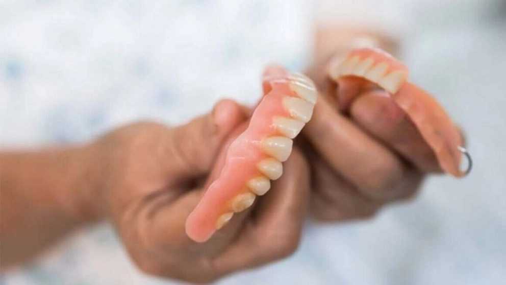 اصول مراقبت از دندان مصنوعی