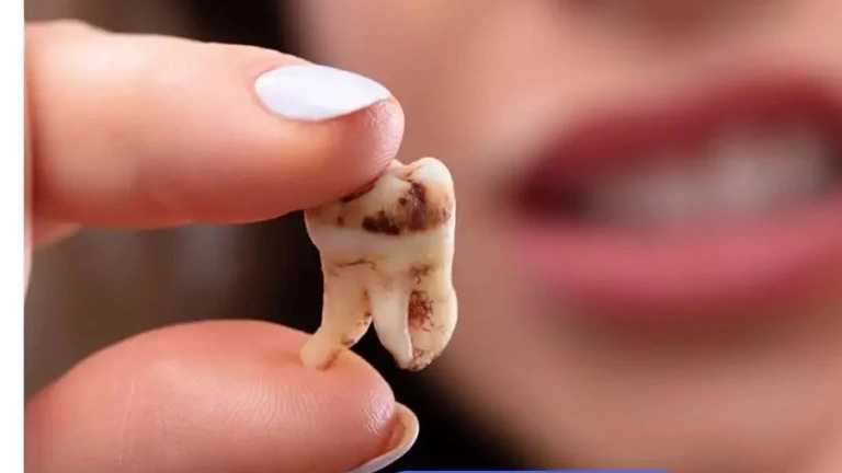 7 مزیت مهم مراجعه منظم به دندانپزشکی