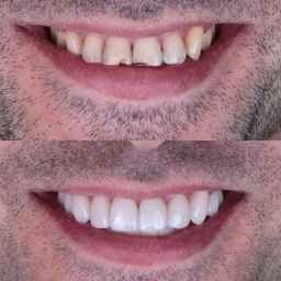 طب أسنان الدكتور أميني