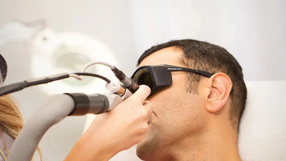 Laser hair removal for men in Mashhad